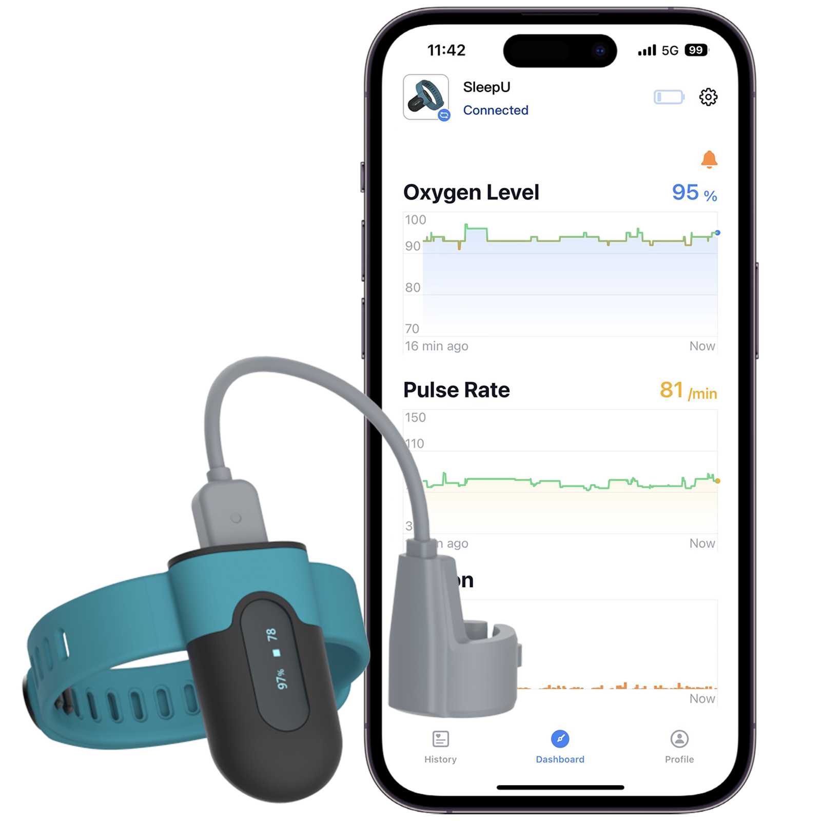 Viatom SleepU: unidad de muñeca, sensor de dedo y ejemplo de ViHealth